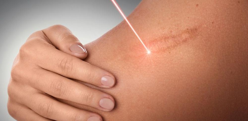 How Laser Treatments Enhance Skin Health at the Laser Center of Marin